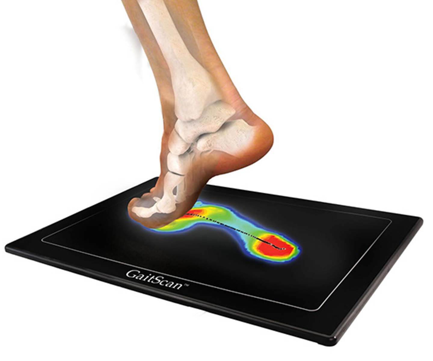 Gait Analysis